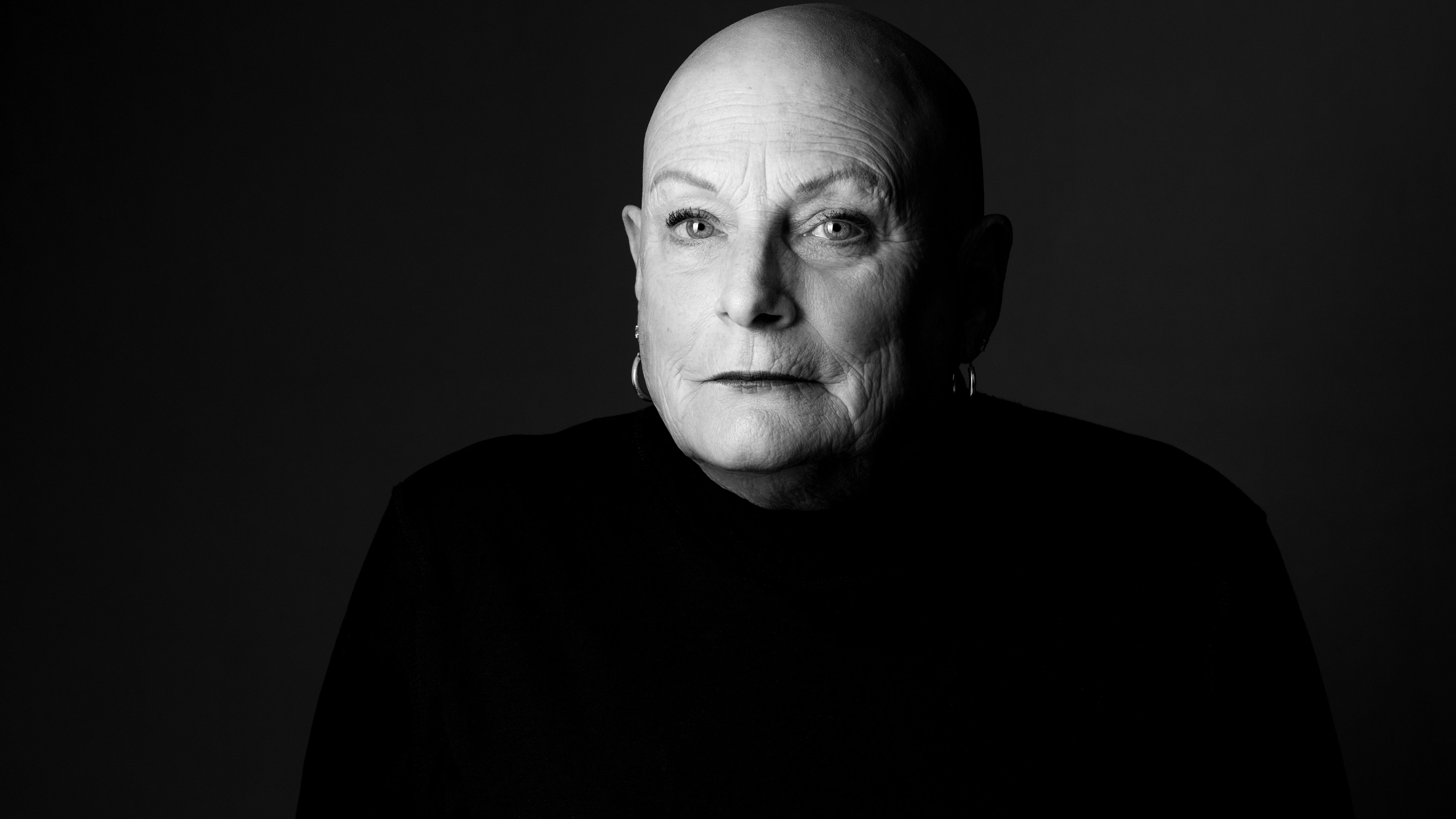 women with alopecia in black and white