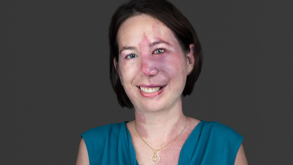 professional headshot of a adult with facital differences
